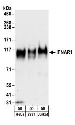 IFNAR1 Antibody in Western Blot (WB)