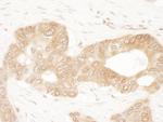 ACAT2 Antibody in Immunohistochemistry (Paraffin) (IHC (P))