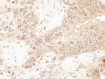 ACAT2 Antibody in Immunohistochemistry (Paraffin) (IHC (P))