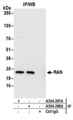 RAN Antibody in Immunoprecipitation (IP)