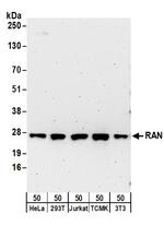 RAN Antibody in Western Blot (WB)