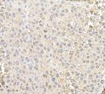 RAN Antibody in Immunohistochemistry (Paraffin) (IHC (P))