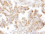 DLST Antibody in Immunohistochemistry (Paraffin) (IHC (P))