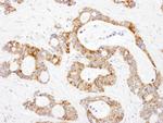 DLST Antibody in Immunohistochemistry (Paraffin) (IHC (P))