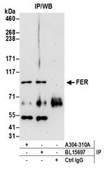 FER Antibody in Immunoprecipitation (IP)