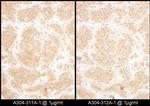 GART Antibody in Immunohistochemistry (Paraffin) (IHC (P))