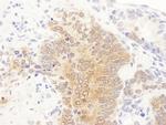 GART Antibody in Immunohistochemistry (Paraffin) (IHC (P))