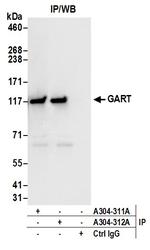 GART Antibody in Immunoprecipitation (IP)