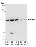 GART Antibody in Western Blot (WB)