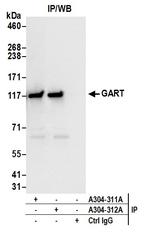 GART Antibody in Immunoprecipitation (IP)