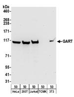 GART Antibody in Western Blot (WB)