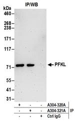 PFKL Antibody in Immunoprecipitation (IP)