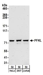 PFKL Antibody in Western Blot (WB)