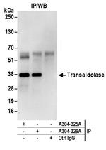 Transaldolase Antibody in Immunoprecipitation (IP)