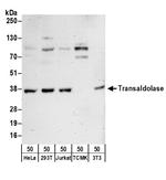 Transaldolase Antibody in Western Blot (WB)