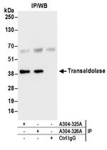 Transaldolase Antibody in Immunoprecipitation (IP)