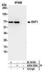 ENT1 Antibody in Immunoprecipitation (IP)