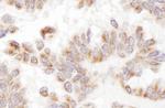 Presenilin-2 Antibody in Immunohistochemistry (Paraffin) (IHC (P))