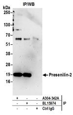 Presenilin-2 Antibody in Immunoprecipitation (IP)