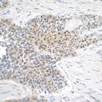 MGEA5 Antibody in Immunohistochemistry (Paraffin) (IHC (P))