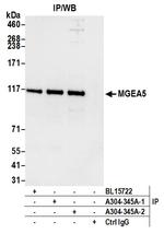 MGEA5 Antibody in Immunoprecipitation (IP)