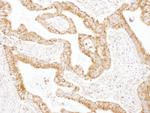 GOT2 Antibody in Immunohistochemistry (Paraffin) (IHC (P))