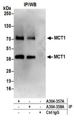 MCT1 Antibody in Immunoprecipitation (IP)