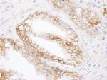 MCT1 Antibody in Immunohistochemistry (Paraffin) (IHC (P))