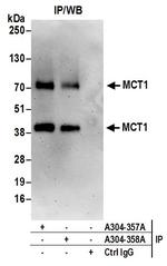 MCT1 Antibody in Immunoprecipitation (IP)