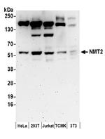 NMT2 Antibody in Western Blot (WB)