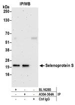 Selenoprotein S Antibody in Immunoprecipitation (IP)