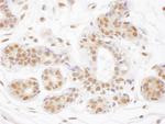 TDG Antibody in Immunohistochemistry (Paraffin) (IHC (P))