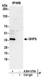 DHPS Antibody in Immunoprecipitation (IP)