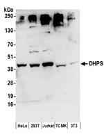 DHPS Antibody in Western Blot (WB)