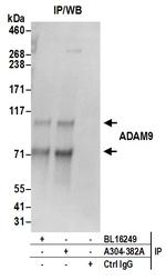 ADAM9 Antibody in Immunoprecipitation (IP)