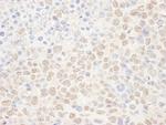 NAT10 Antibody in Immunohistochemistry (Paraffin) (IHC (P))