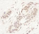 NAT10 Antibody in Immunohistochemistry (Paraffin) (IHC (P))