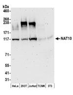 NAT10 Antibody in Western Blot (WB)