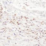 CD43 Antibody in Immunohistochemistry (Paraffin) (IHC (P))