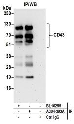 CD43 Antibody in Immunoprecipitation (IP)