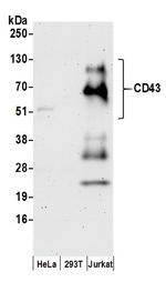 CD43 Antibody in Western Blot (WB)