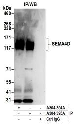 SEMA4D Antibody in Immunoprecipitation (IP)