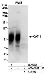 CAT-1 Antibody in Immunoprecipitation (IP)