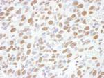 Phospho-RNA Polymerase II (Ser2) Antibody in Immunohistochemistry (Paraffin) (IHC (P))