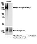 Phospho-RNA Polymerase II (Ser2) Antibody in Immunoprecipitation (IP)