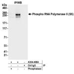 Phospho-RNA Polymerase II (Ser5) Antibody in Immunoprecipitation (IP)