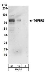 TGFBR2 Antibody in Western Blot (WB)