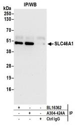 SLC46A1 Antibody in Immunoprecipitation (IP)