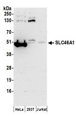 SLC46A1 Antibody in Western Blot (WB)