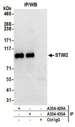 STIM2 Antibody in Immunoprecipitation (IP)